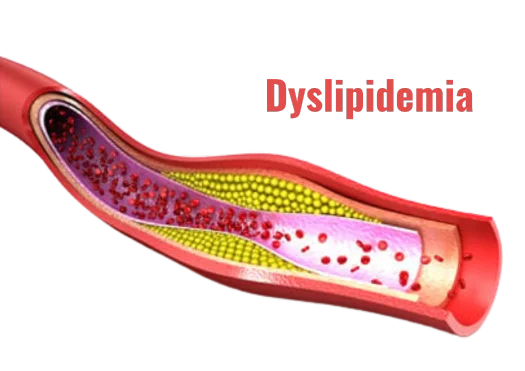 Dyslipidemia